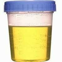 Urine Container