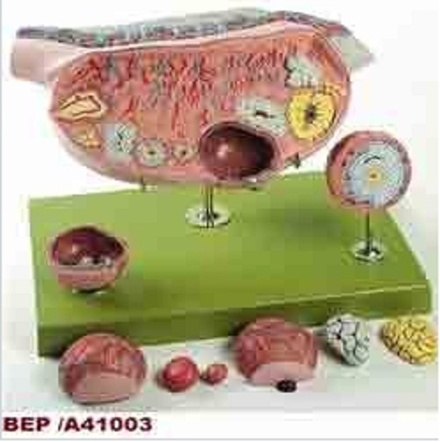 Medical Model
