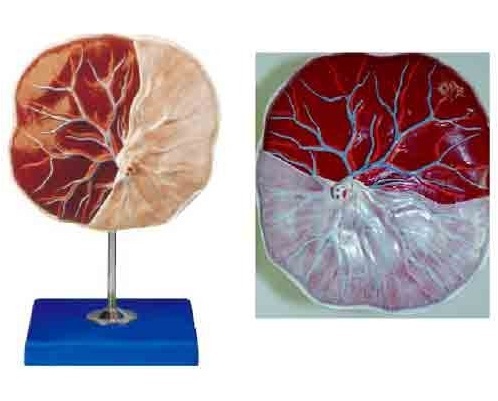 Gynecological Models