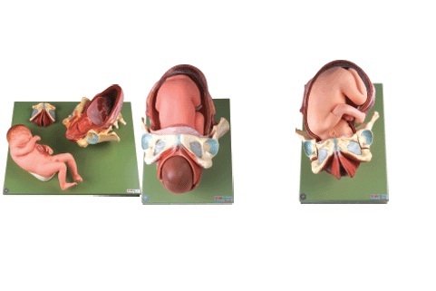 Gynecological Models