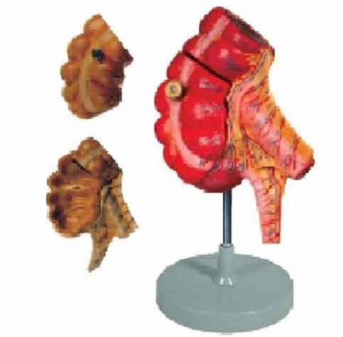 Appendix And Caecum ( BEP/A 12006 )