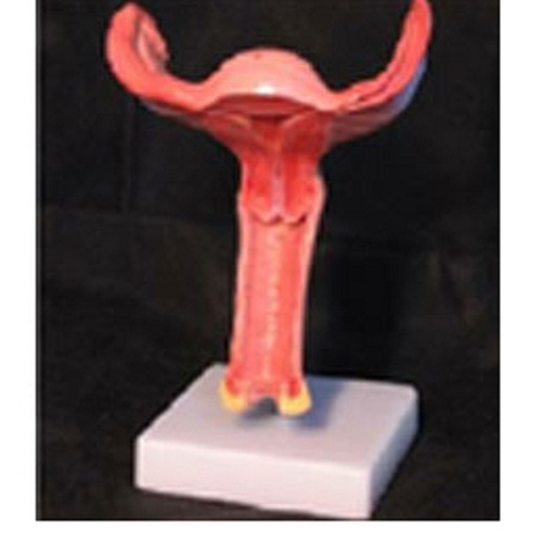 Magnified Uterus Model ( BEP-436A )
