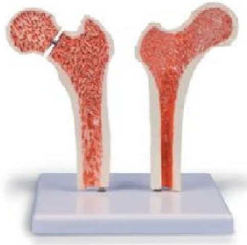 Femur Bone Model ( BEP-120 )