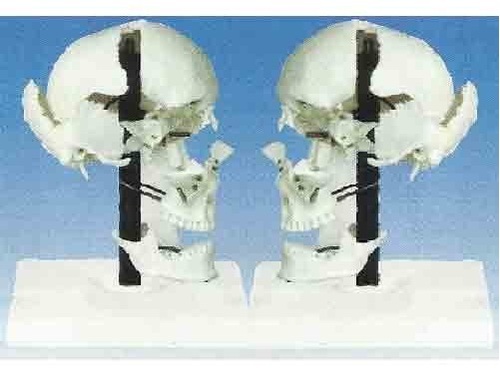 Skull Model