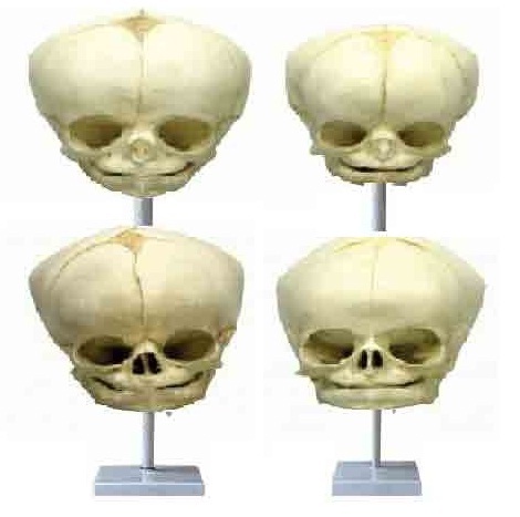 Fetal Child Skull Model ( BEP-121 )