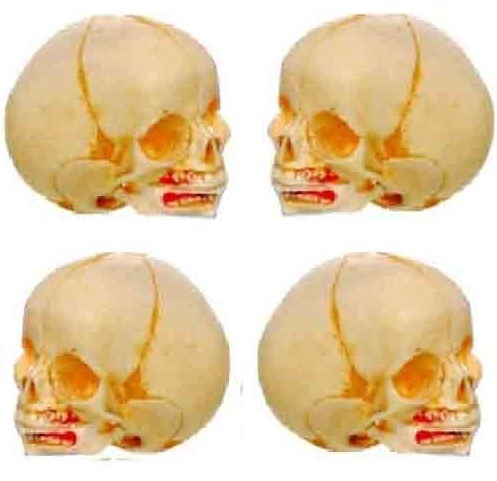 Infant Skull Model ( BEP/A 11115 )