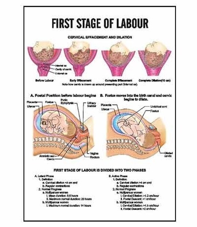 INC03 - First Stage Of Labour Charts - INC03 - First Stage Of Labour ...