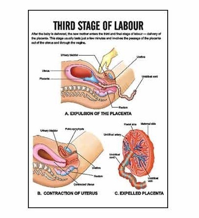 INC05 - Third Stage Of Labour