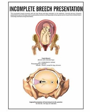 Midwifery & Child Health Nursing Charts