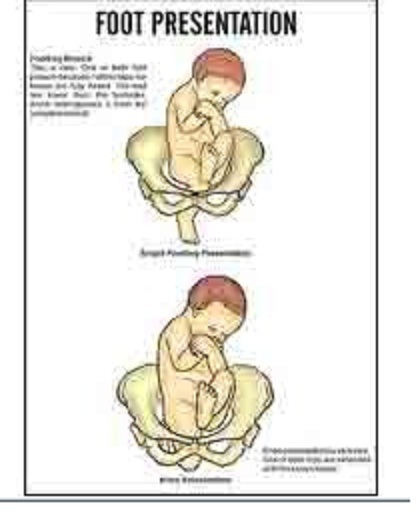 Midwifery & Child Health Nursing Charts