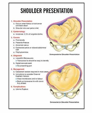 Midwifery & Child Health Nursing Charts