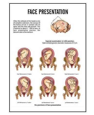 Midwifery & Child Health Nursing Charts