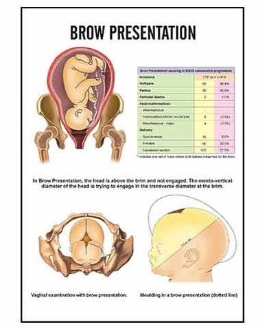 Midwifery & Child Health Nursing Charts