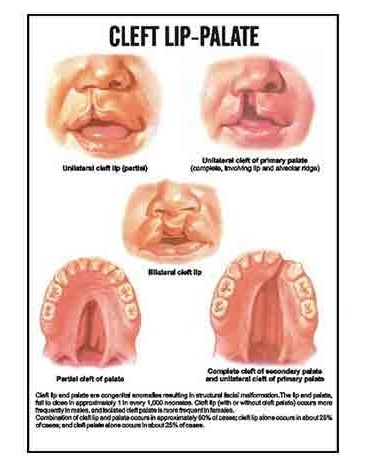 Midwifery & Child Health Nursing Charts