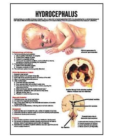 Midwifery & Child Health Nursing Charts