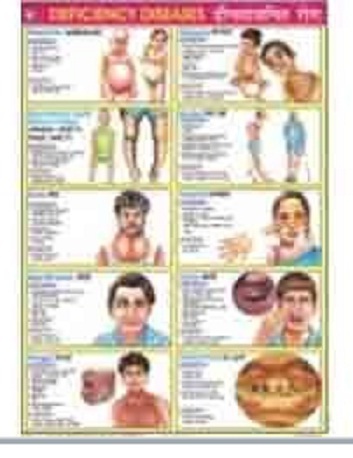 Food And Nutrition Charts