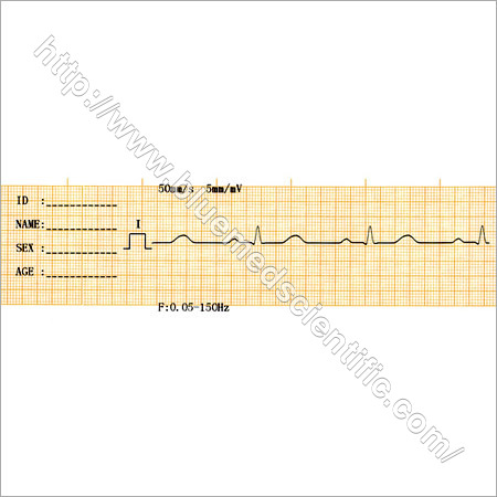 ECG Machine
