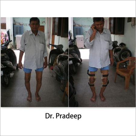 Arthritis Knee Brace