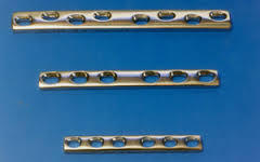 Dynamic Compression Plate