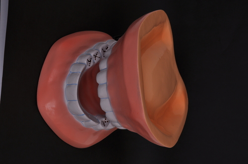 Tooth Care Model