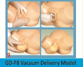 Vacuum Delivery Model