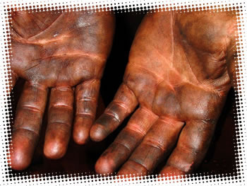 Waterless Hand Degreaser