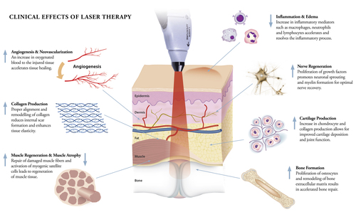 Laser Therapy Clinical Effects