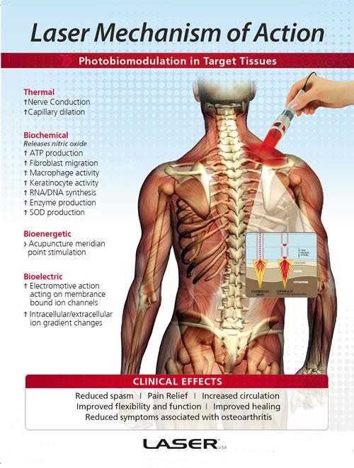 Laser Therapy Equipment