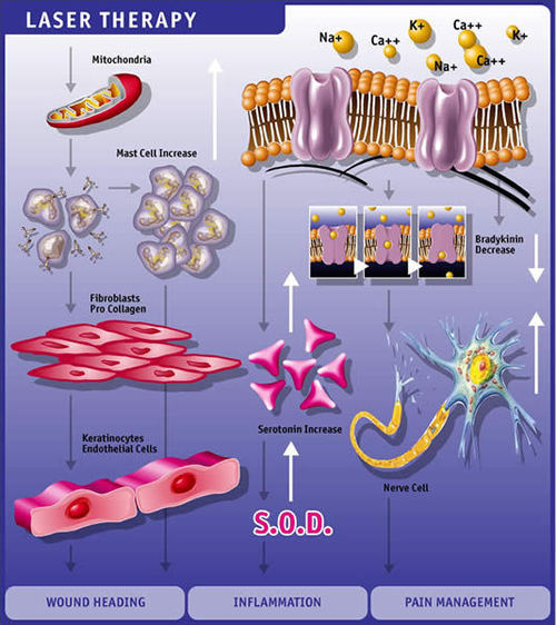 Laser Therapy Effects