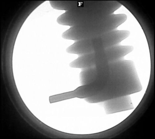 Insulator Testing X-Ray Devices