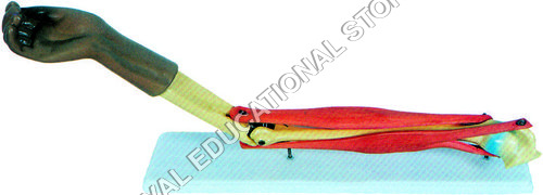 FUNCTIONAL ELBOW JOINT