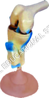 FUNCTIONAL KNEE JOINT