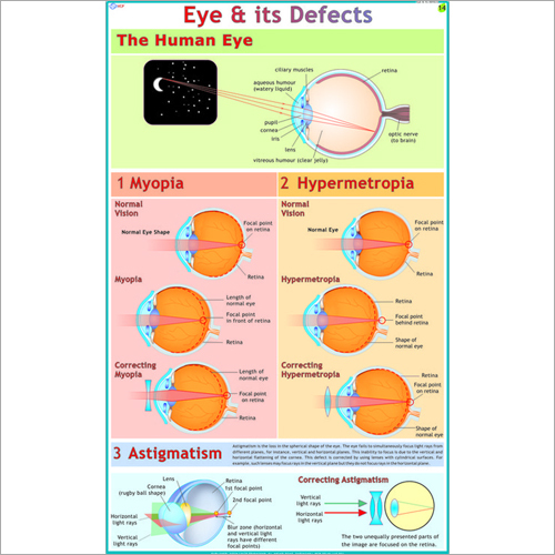 The Eyes : Its Defects & Remedies Chart