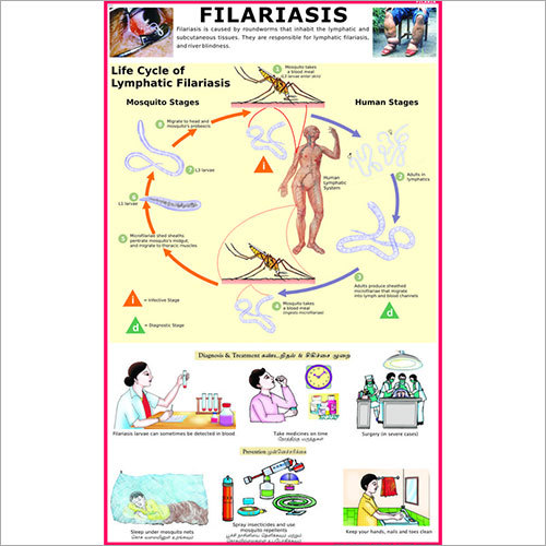 Filariasis (Life Cycle of Roundworm) Chart