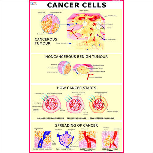 Cancer Cells Chart Dimensions: 70 X 100  Centimeter (Cm)