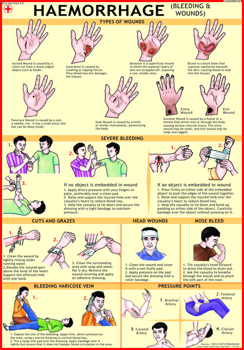 Haemorrhage (Bleeding & Wounds) Chart