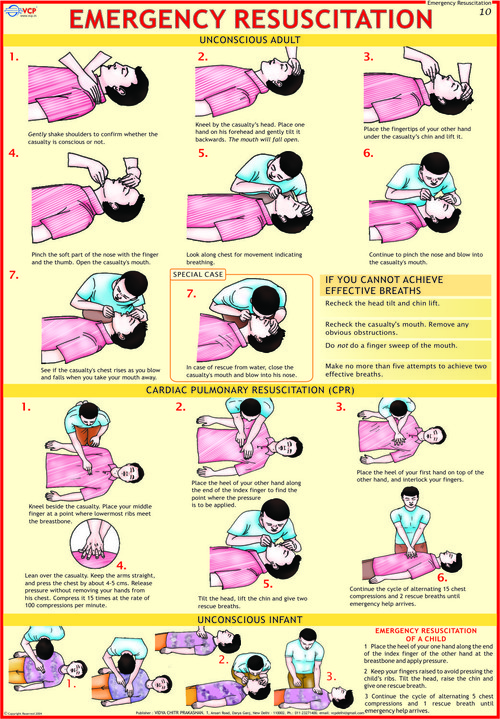 Emergency Resuscitation Chart Dimensions: 70 X 100  Centimeter (Cm)