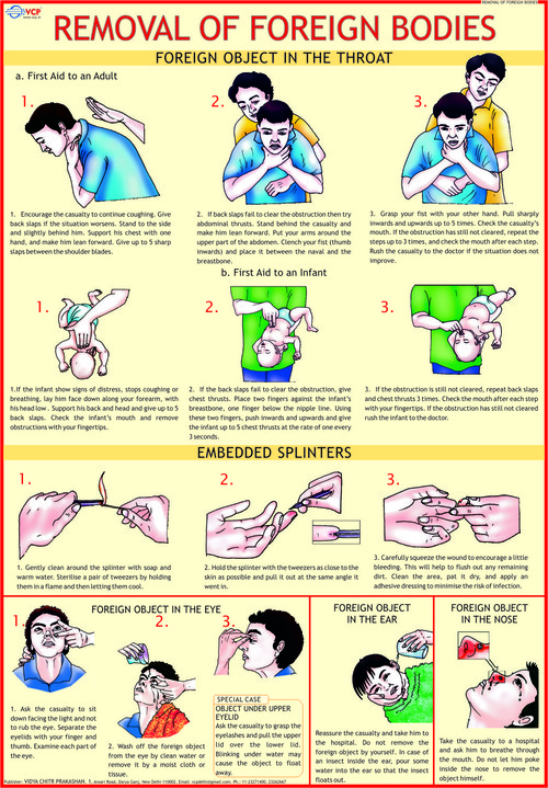 Removal of Foreign Bodies Chart