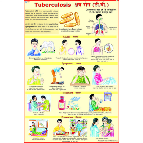 Tuberculosis Causes Chart