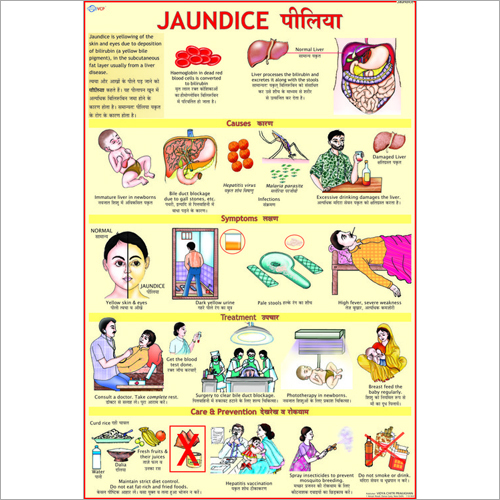 Jaundice Symptoms Chart