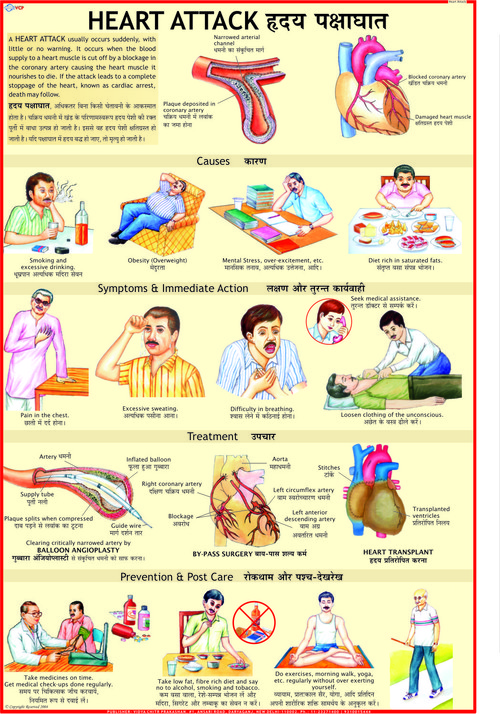 Heart Attack Chart