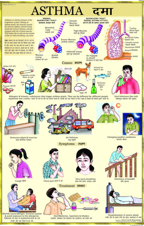Asthma Chart