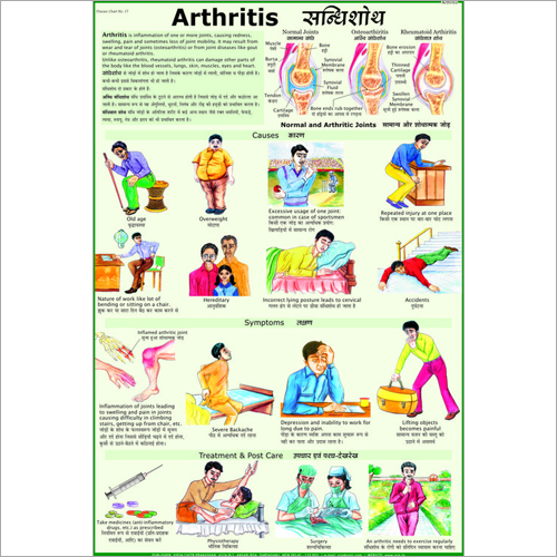 Arthritis Chart