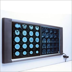 X- Ray Viewer