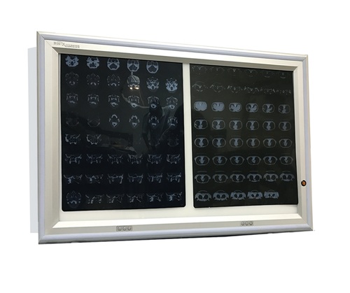 Flush Mounted LED X-Ray Film Viewer
