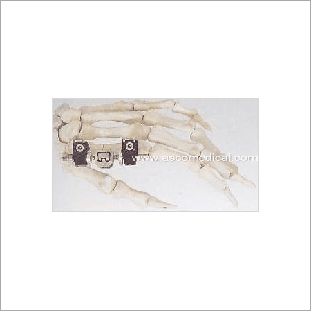 Mini Fragment External Fixator (Finger and Palm)