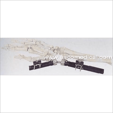 Distal Radius Fragment External Fixator - Surgical Steel, Variable Dimensions | Adjustable Clamps, Stable Fixation, Precise Adjustment