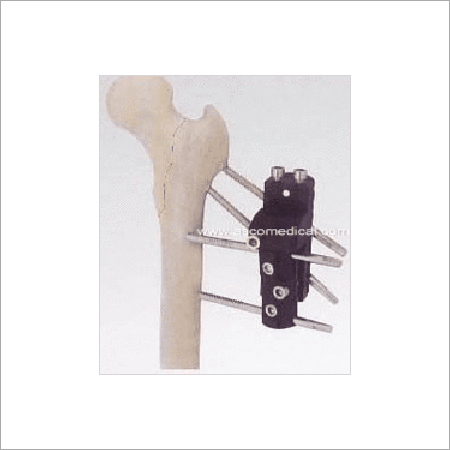 Proximal Femoral Fragment External Fixator - Titanium Alloy, Varied Sizes | Secure Clamps, Stable Fixation, Precise Adjustment, Lightweight