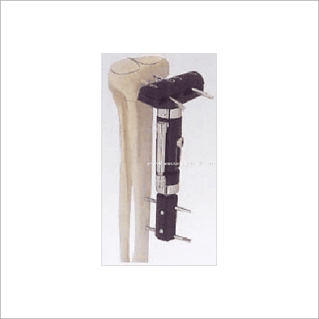 Proximal Tibial Fragment External Fixator