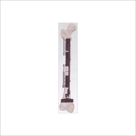 Bone Lengthening External Fixator - Titanium Alloy, Variable Dimensions, Micrometer Length Adjustment | Precise Lengthening, Stable Fixation, Minimally Invasive, Adjustable Length, Biocompatible, Infection Resistant